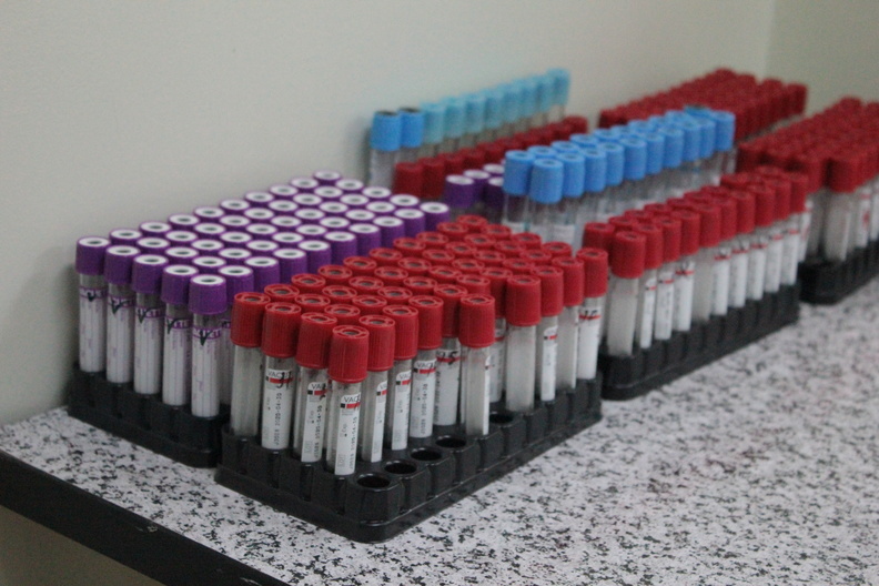 В Удмуртии зафиксировано 110 случаев заражения коронавирусом