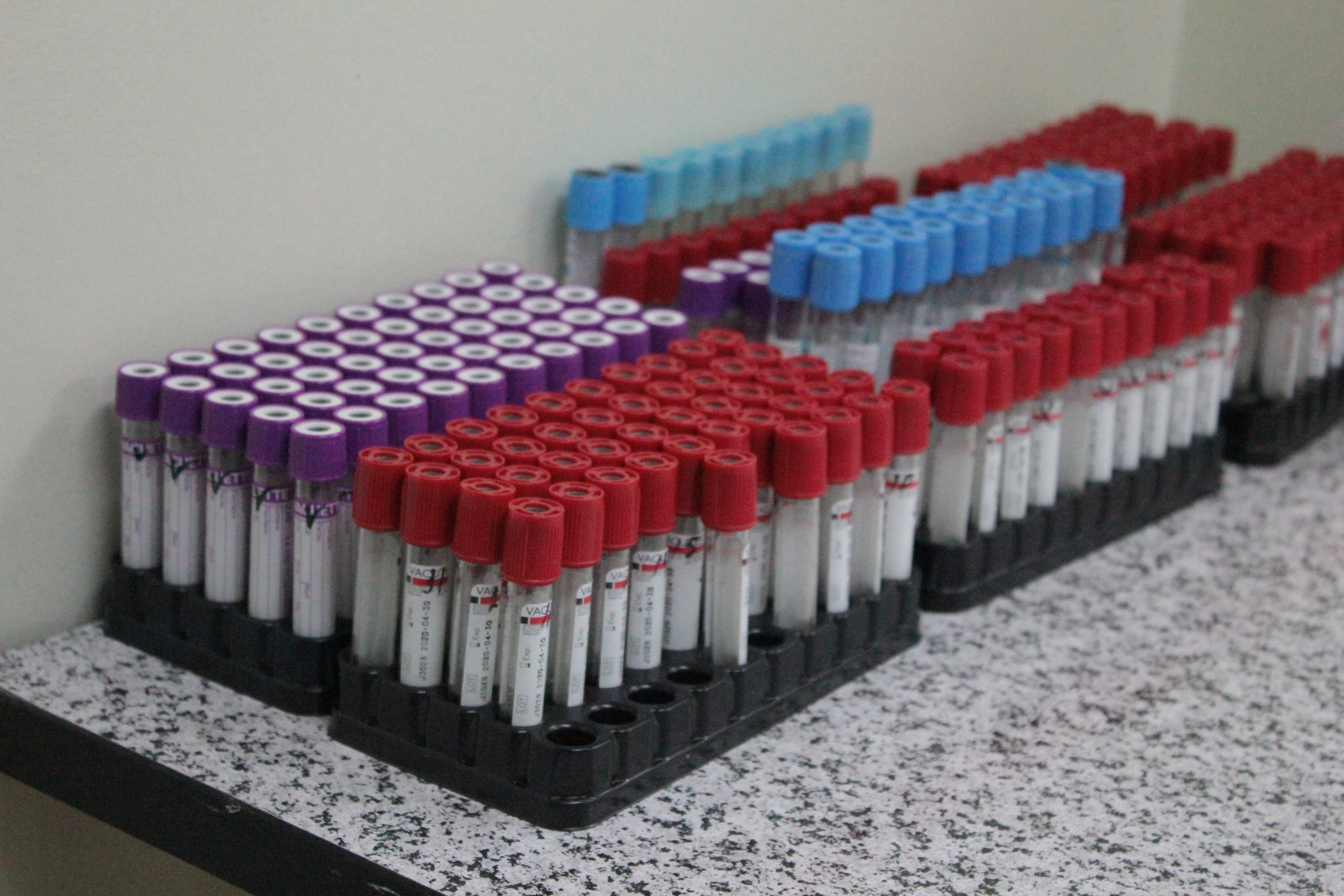 За сутки в Удмуртии проведено около 2 тысяч исследований на коронавирус