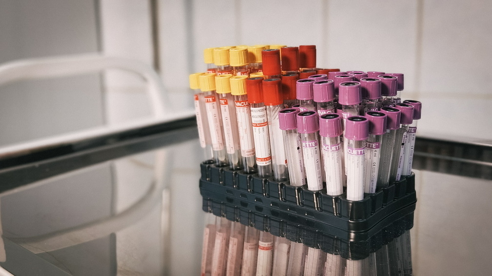 31 житель Удмуртии с диагнозом «коронавирус» подключен к аппарату ИВЛ