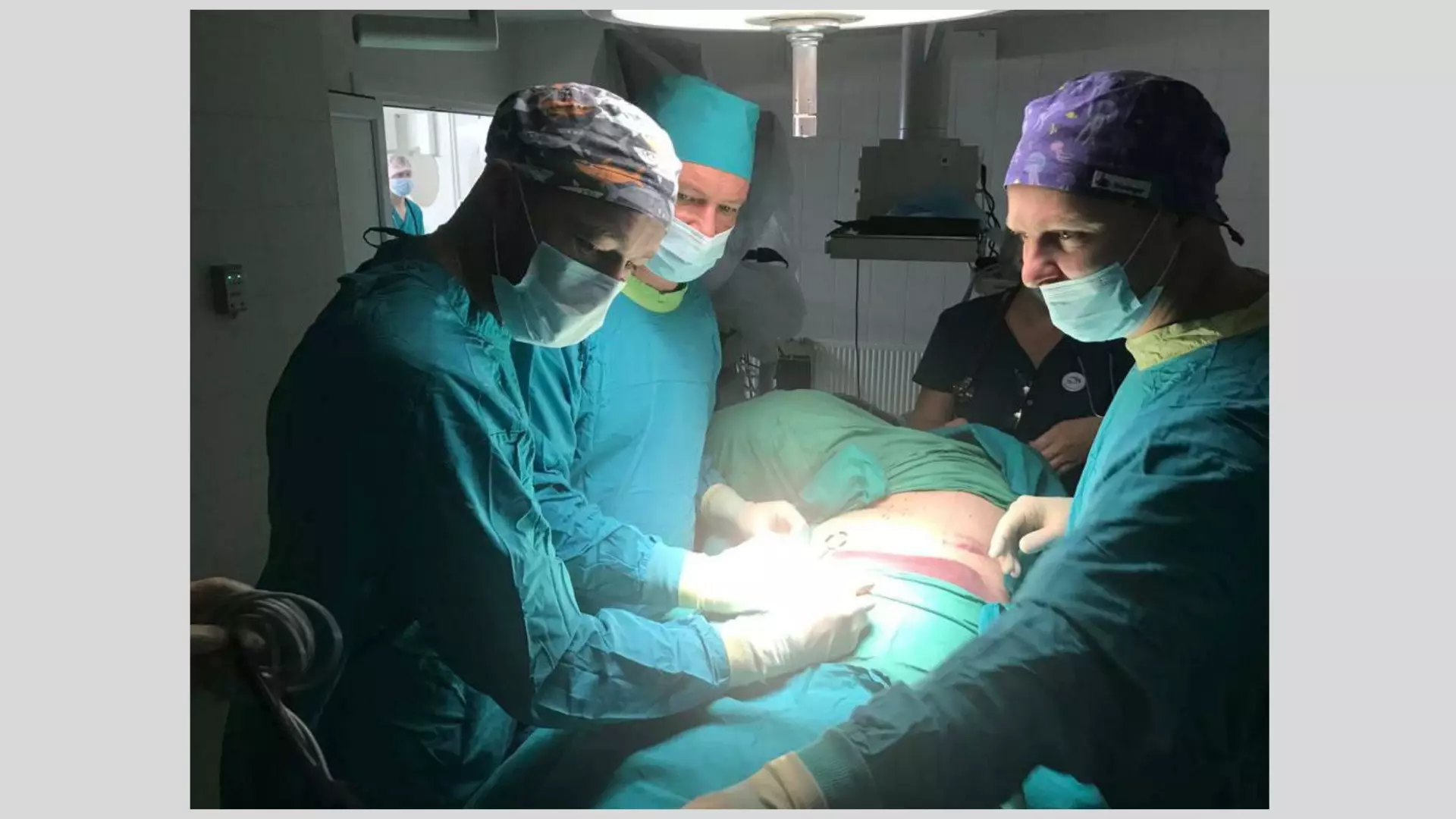 Хирурги ГКБ №9 Ижевска прооперировали пациентку с редкой легочной грыжей
